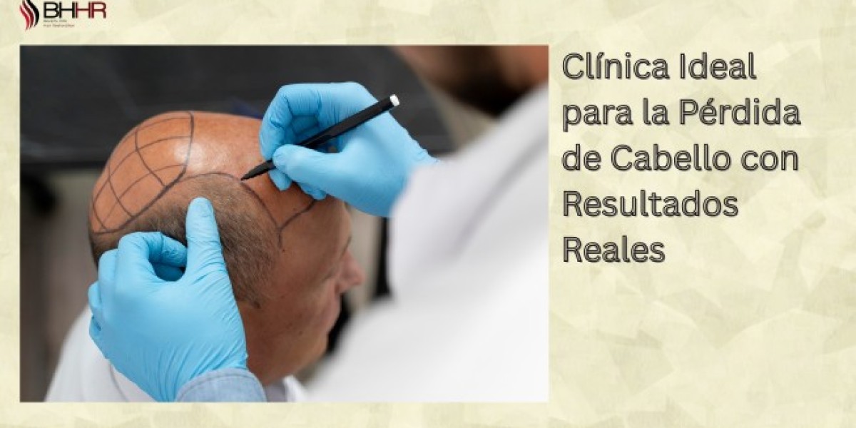 Clínica Ideal para la Pérdida de Cabello con Resultados Reales